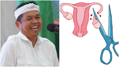 Gubernur Jabar Dedi Mulyadi Mau Jadikan Vasektomi Syarat Terima Bansos, Komnas HAM: Langgar Hak Privasi